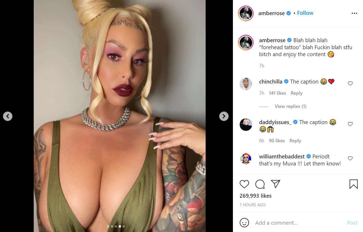 Amber Rose tells people to STFU about her forehead tatoo, as she enjoys hoe life