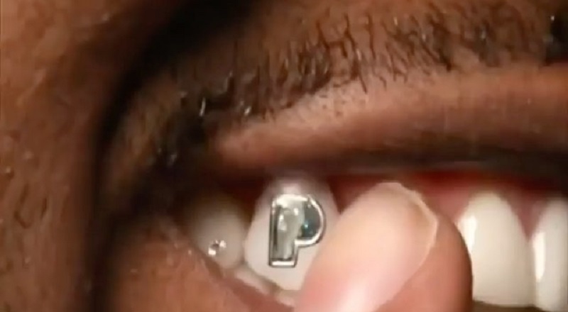 Gunna gets 100K P diamond in his tooth to celebrate Pushin P