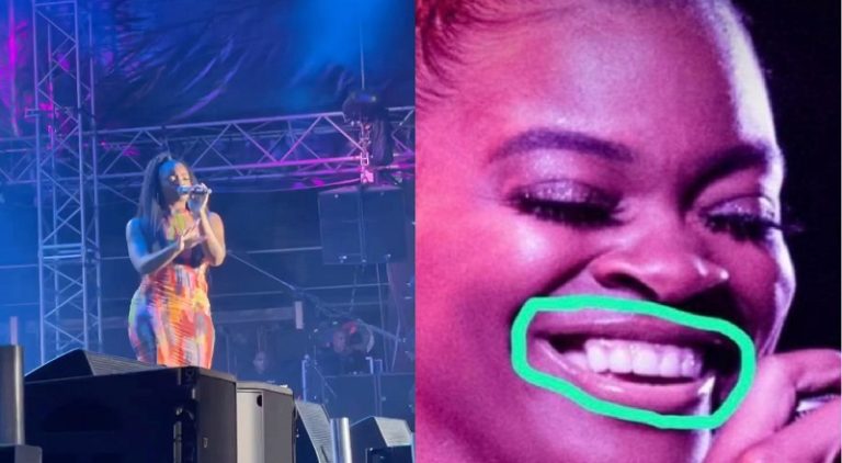 Ari Lennox gets clowned for having a missing tooth