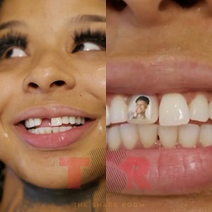 Chrisean Rock gets Blueface's photo added to her new tooth