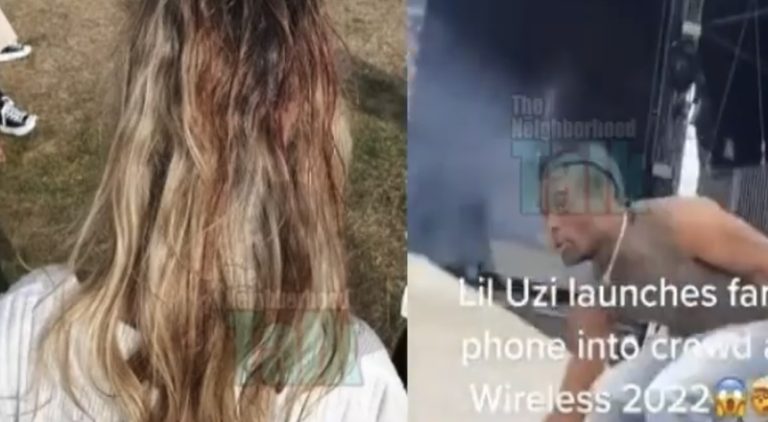 Fan injures head after Lil Uzi Vert throws phone during performance